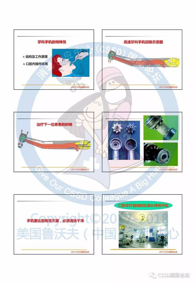 【2017cssd国际论坛课程笔记】讲者:曾淑蓉——牙科手机与种植手术