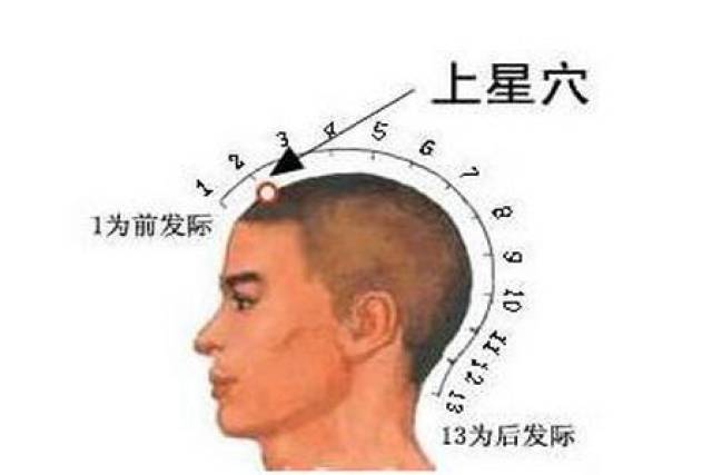 过敏性鼻炎让人烦!这个方法很有效