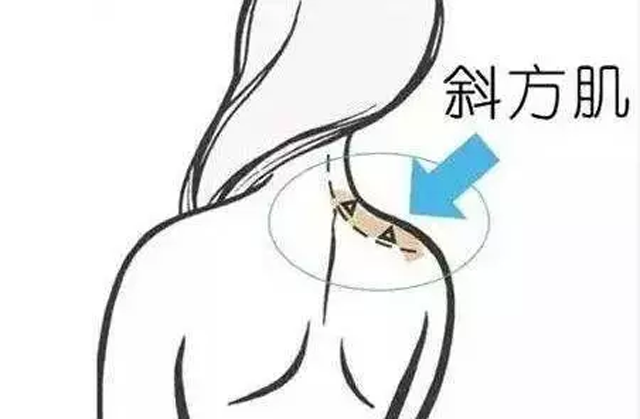 吕晓杰:那个一个月前打瘦肩针的女孩现在怎么样了?