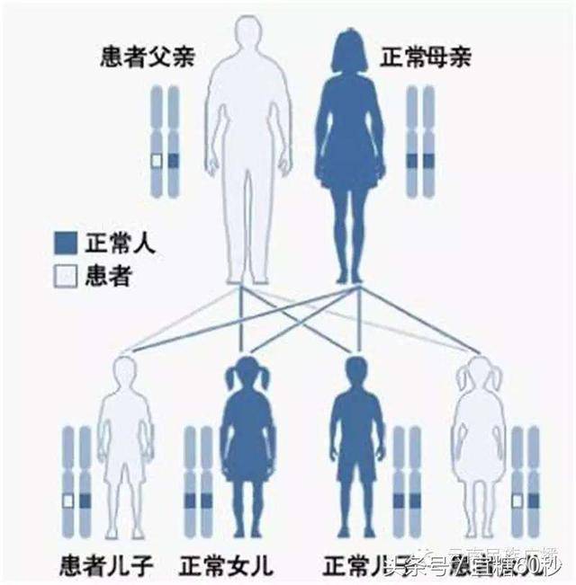 不同类型的糖尿病,遗传概率是多少?终于明白了!