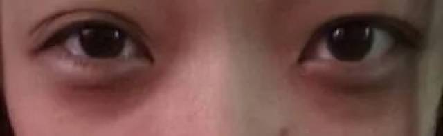 透露你年龄秘密的杀手