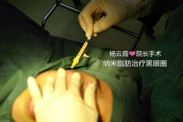 透露你年龄秘密的杀手