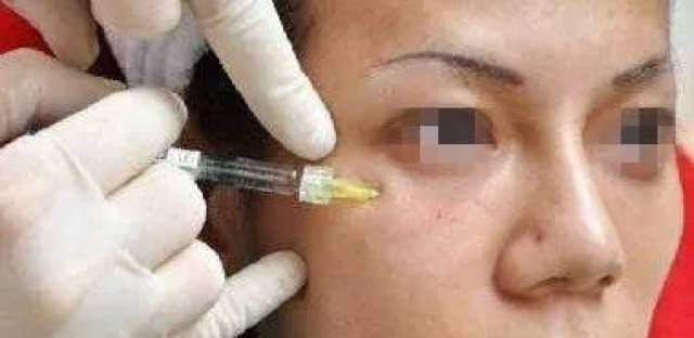 透露你年龄秘密的杀手