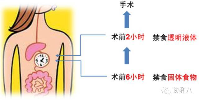 肠道准备,到底该如何做?