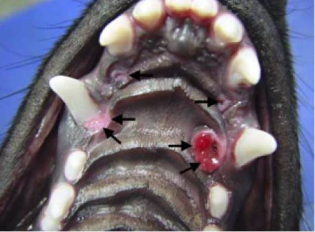 小颌畸形micrognathia,过短的下颌导致犬齿完全无法回归正常解剖位置