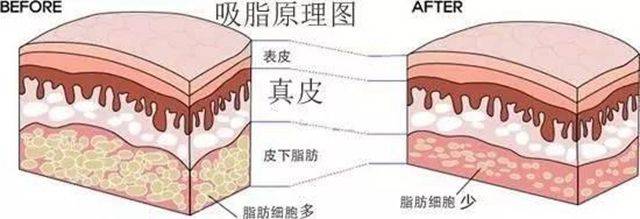 不甘心做一个胖子,却又不喜欢运动,那么你只有一条路可走