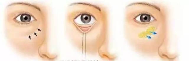 透露你年龄秘密的杀手