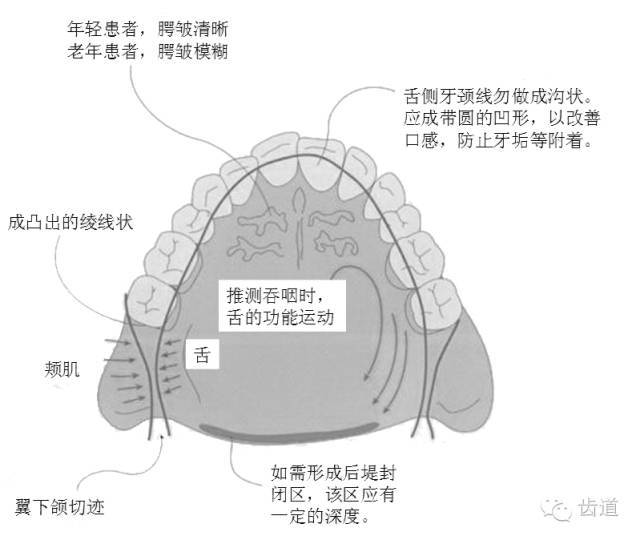 6 要点图示六  1,观察已排列成形的人工牙牙体长轴,想象牙根与牙槽骨