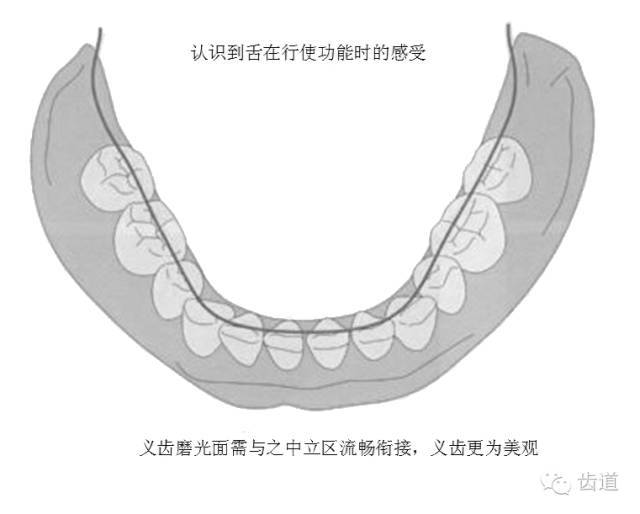 6 要点图示六  1,观察已排列成形的人工牙牙体长轴,想象牙根与牙槽骨