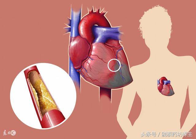 心脏病有哪些危害,应该怎么预防?吸烟和55岁以上的人注意了!