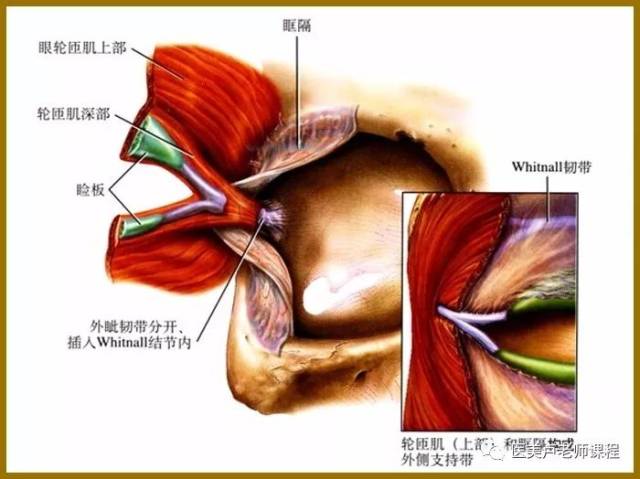 外眦的解剖结构与外眦开大术