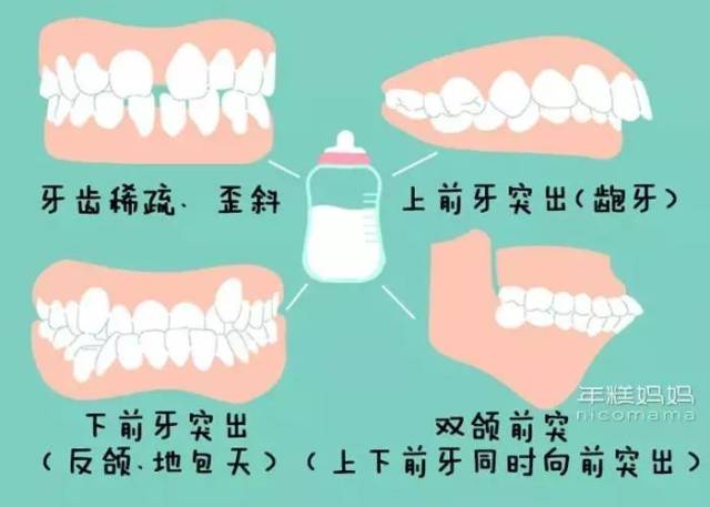 2岁3岁了还在用奶瓶?不健康,毁颜值!