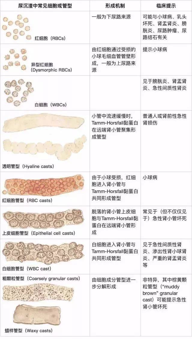 尿沉渣指尿液中的有型成分,主要包括细胞,管型,结晶,微生物等几大类.