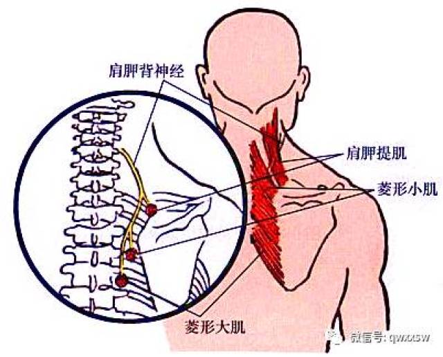 精进专题神经篇——肩胛背,胸长神经