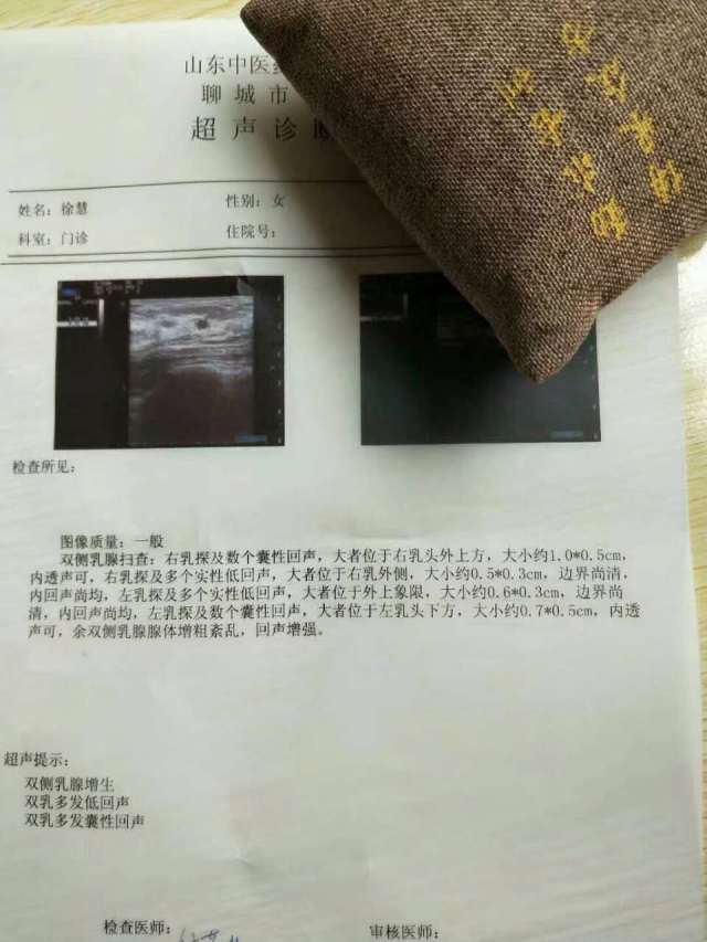 严重乳腺增生,钙化灶 名医名方调理案例