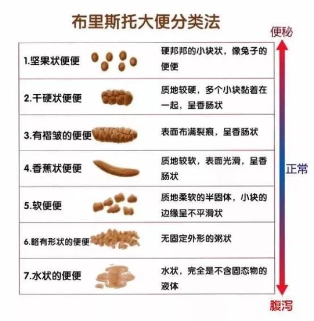 关于便便的形状,可是有专业描述的,那就是 布里斯托大便形状分类.