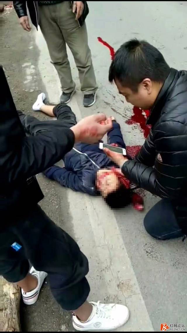 发生一起小型客车与行人相撞的道路交通事故,造成1人经抢救无效死亡