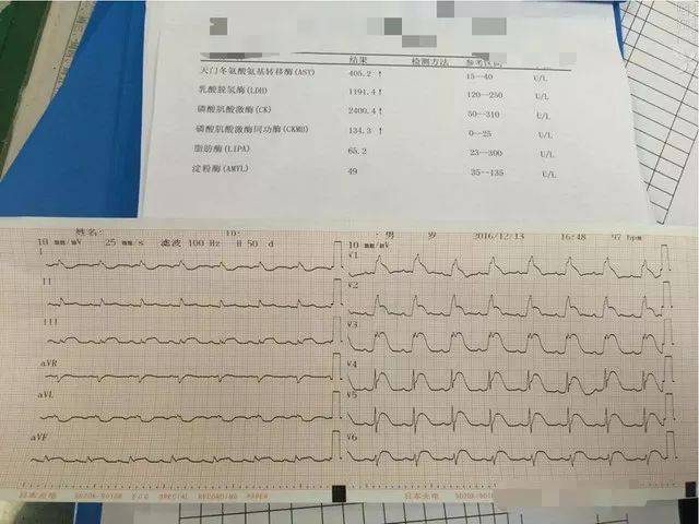 急诊见闻最怕漏诊的病毒性心肌炎