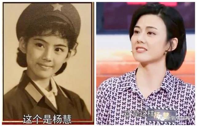 58岁的《芳华》原型杨慧看起来不到30岁,有这3个特征的话你也可以!