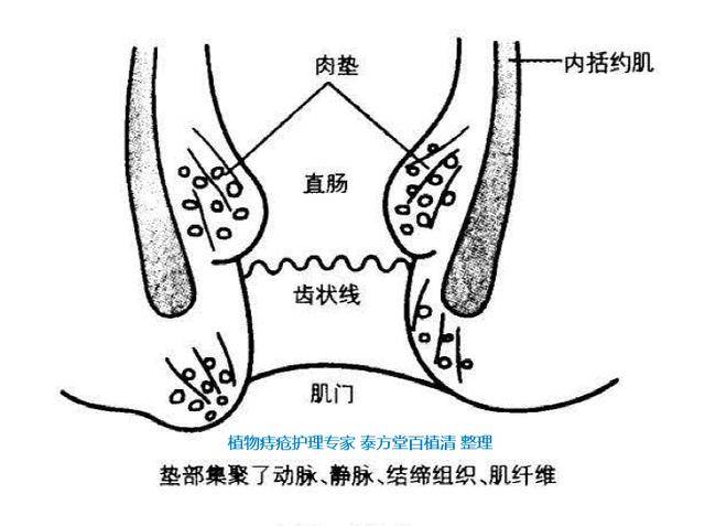 痔疮,肛裂,肛瘘?痔疮到底咋回事?图示告诉你!收藏!转发!