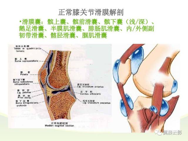 膝关节滑膜病变mri表现