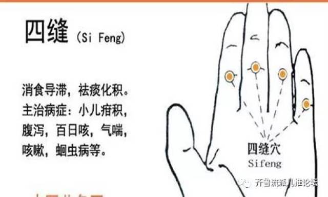 扎扎"扎四缝"穴,不只是治疗小儿厌食症!