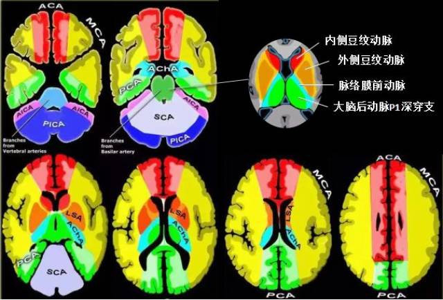 一张图读懂脑动脉供血区域