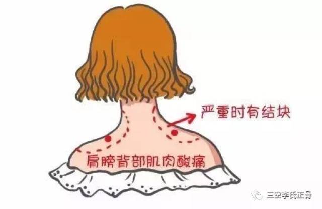 【三空李氏正骨】脖子痛=颈椎病?医生告诉你