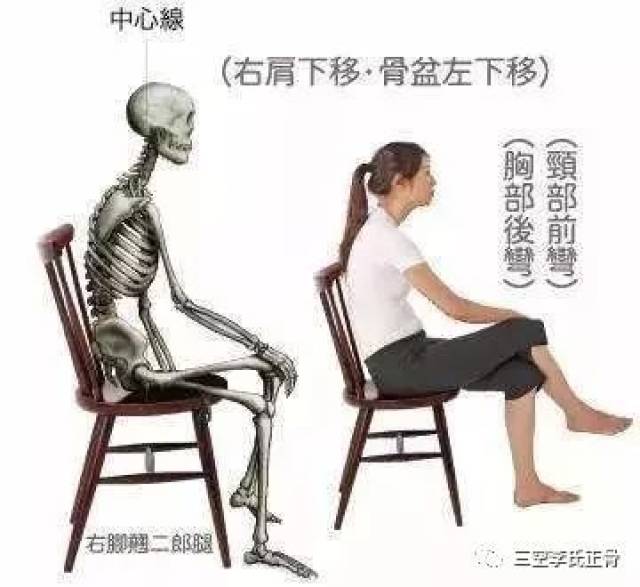 【危害】导致骨盆歪斜,腰椎后凸,脊椎侧弯,颈椎前凸.