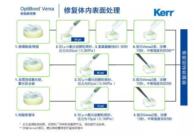 垫底,粘接,充填,最细致的图文操作流程