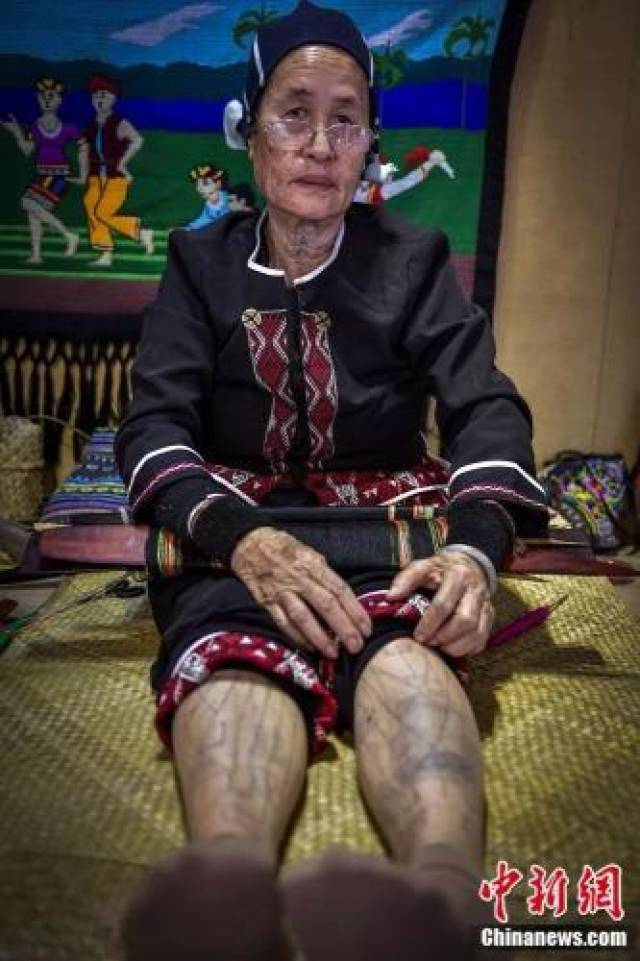 75岁的黎族阿婆符金花展示腿部文身.骆云飞 摄