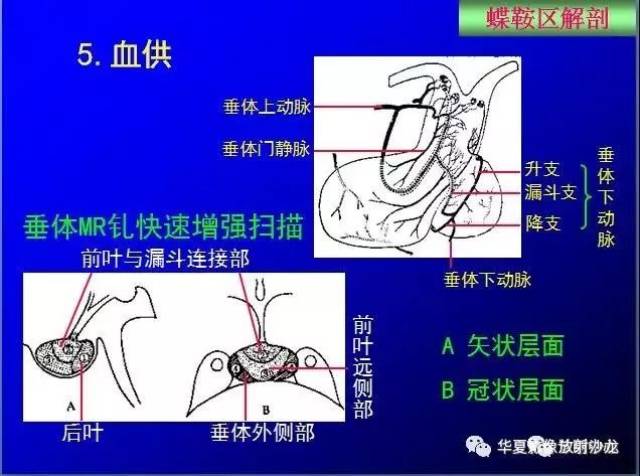 这么全的鞍区影像解剖,赶紧收藏备用!