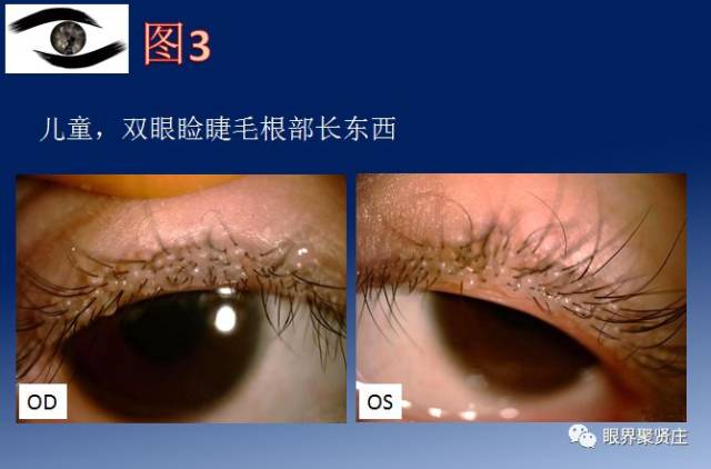 看图识病九宫格系列|眼睑眼眶病