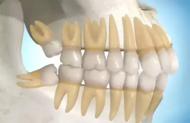 人有两副牙齿,一副是乳牙,一副是恒牙!
