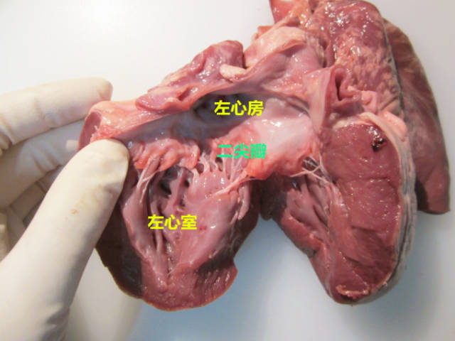 心脏的法医学解剖