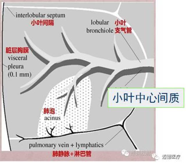 进入次级肺小叶后,包绕小叶中心支气管和肺动脉的间质称为小叶中心间