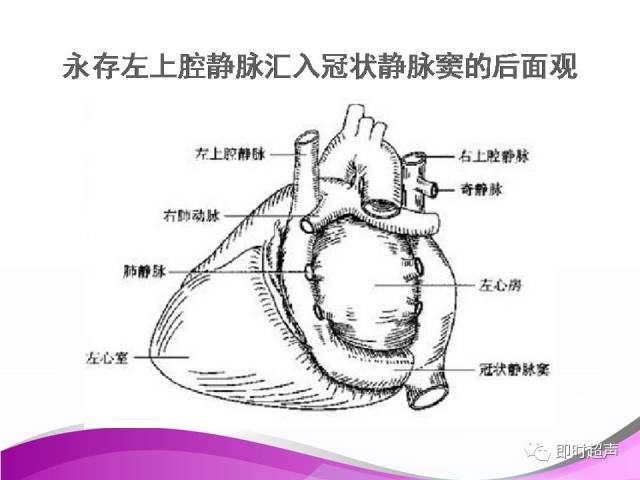 胎儿永存左上腔静脉的超声诊断