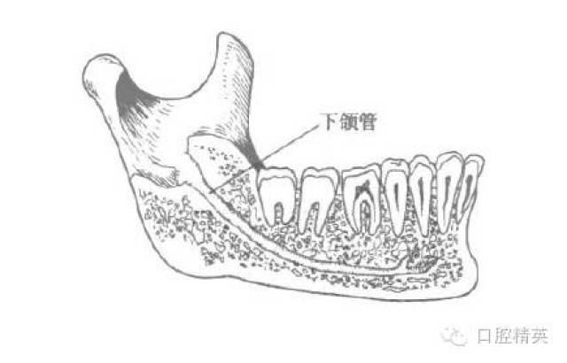 下颌管起自下颌孔止于颏孔,是容纳下牙槽神经与血管的骨性管道.