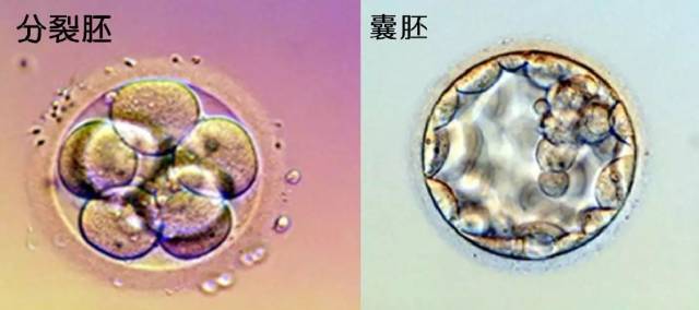 【锦江生殖.科普】深度解析鲜胚,冻胚,囊胚的定义和成功率差异