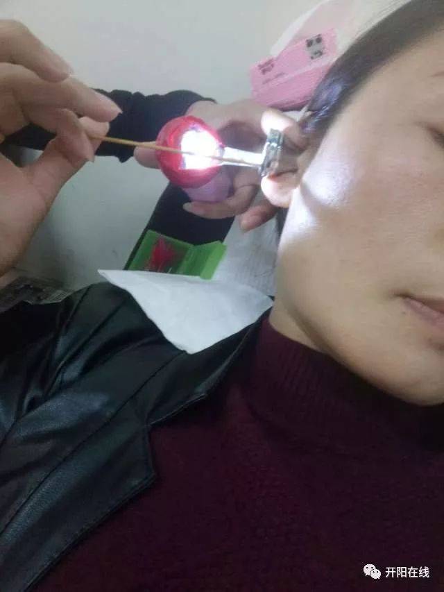 特色洗眼,中耳炎上药,香薰耳烛,肠胃理疗,巧取耳结
