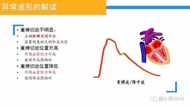 测量动脉血压的原理是什么_肱动脉测量血压图片