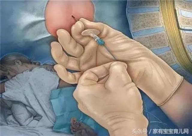 图解顺产,剖腹产全过程!女人生孩子太不