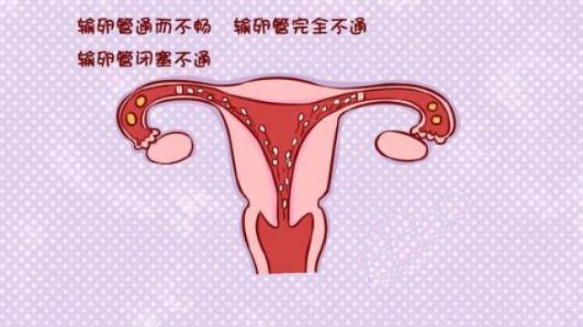 女性不要再做这5件事了,小心让输卵管堵起来