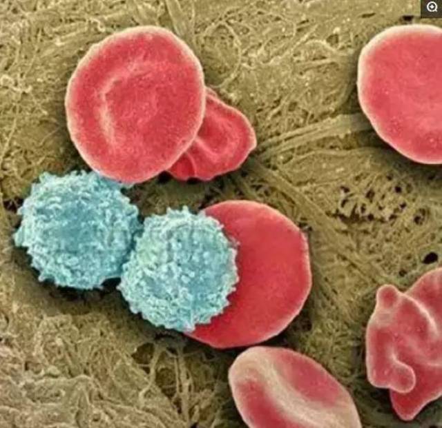 从图看显微镜下的各类癌细胞:画风完全不一样