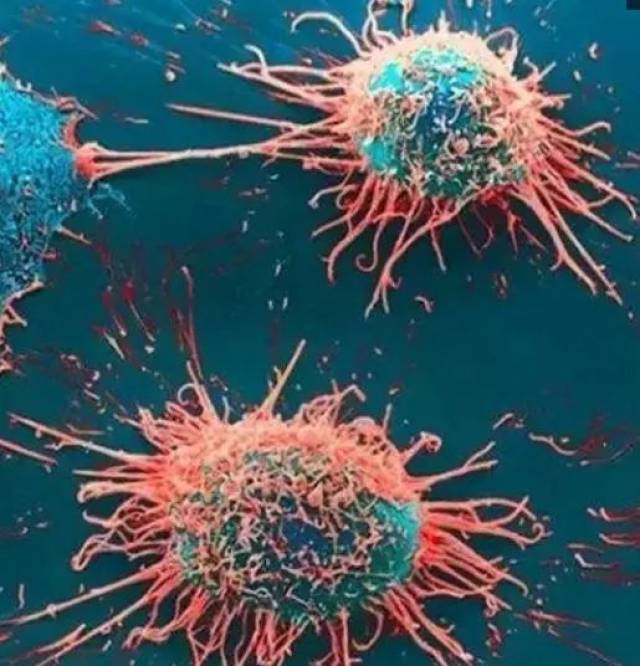 从图看显微镜下的各类癌细胞:画风完全不一样