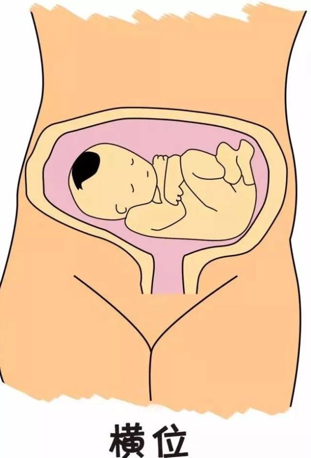 宝宝在子宫里的这些姿势,竟然关系到孕妈是否能够顺产-母婴频道-手机