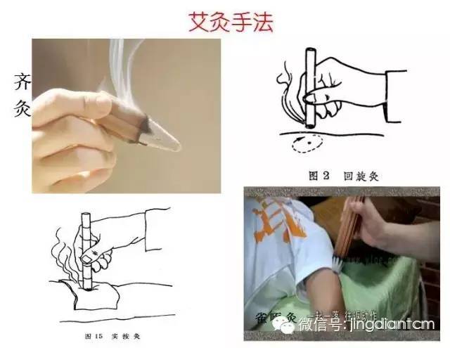 7,操作方法:温和灸,雀啄灸,回旋灸,齐灸(多艾齐灸,单艾齐灸),实按灸