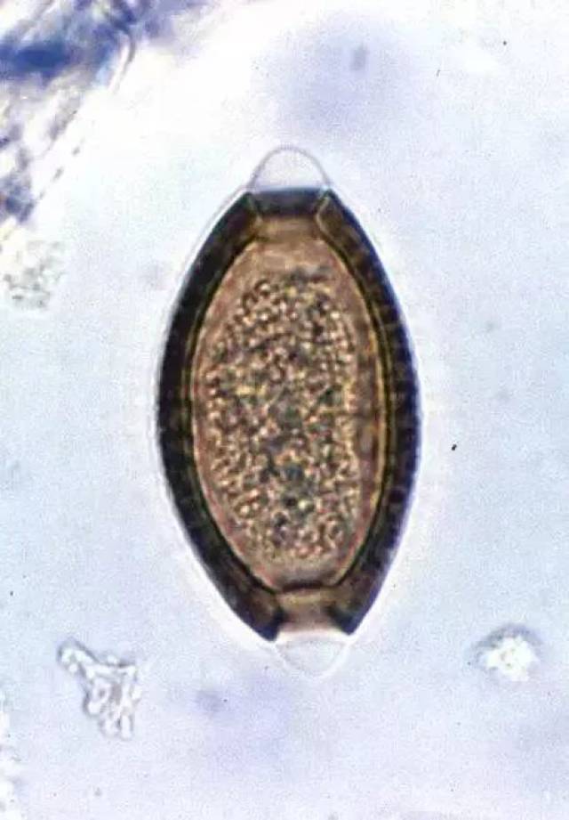 寄生虫学虫卵经典总结及图片