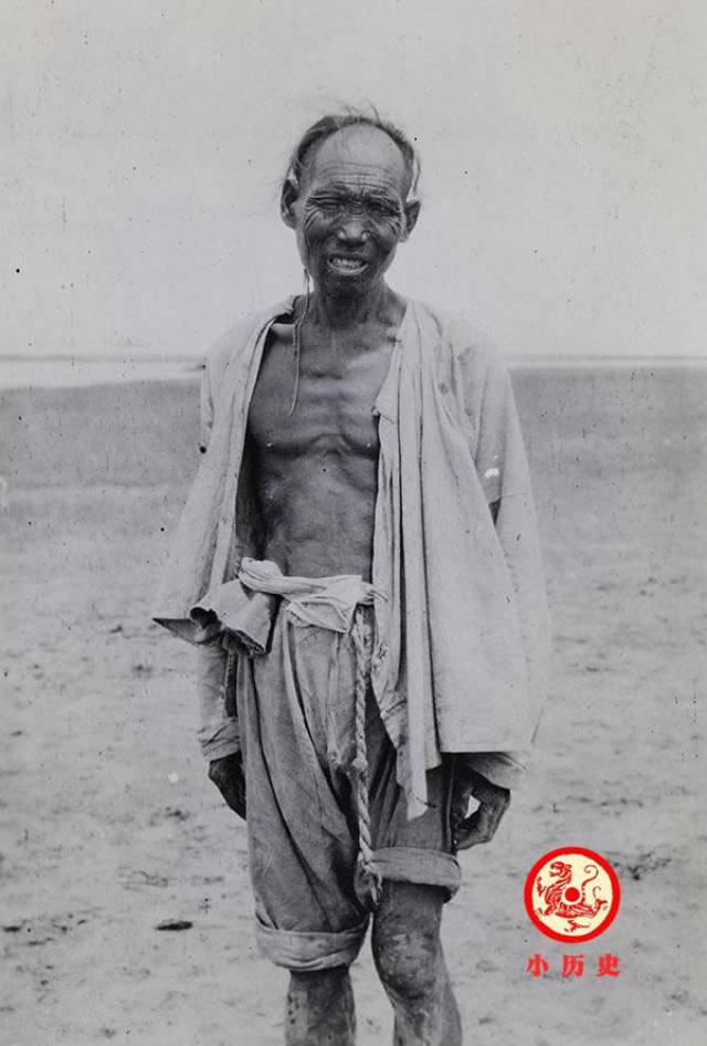 清末民初的乞丐,还是盲人,他的腿上似乎生了皮肤病.