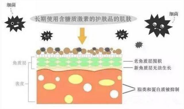 但长时间外用糖皮质激素产品会使角质层的脂类和蛋白质代谢处于被抑制